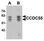 NSRP1 Antibody in Western Blot (WB)