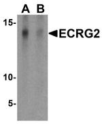 SPINK7 Antibody in Western Blot (WB)