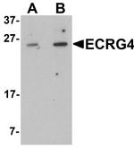 ECRG4 Antibody in Western Blot (WB)