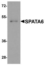 SPATA6 Antibody in Western Blot (WB)