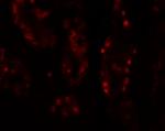 DISP1 Antibody in Immunohistochemistry (Paraffin) (IHC (P))