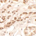 PTCHD2 Antibody in Immunohistochemistry (Paraffin) (IHC (P))