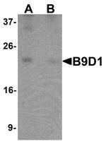 B9D1 Antibody in Western Blot (WB)