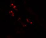 Nkx2.2 Antibody in Immunohistochemistry (Paraffin) (IHC (P))