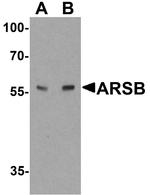 Arylsulfatase B Antibody in Western Blot (WB)