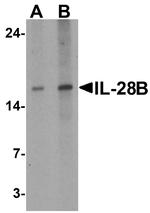 IL-28B Antibody in Western Blot (WB)