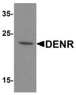 DENR Antibody in Western Blot (WB)