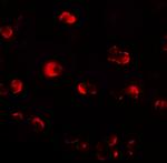 OASL Antibody in Immunocytochemistry (ICC/IF)