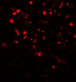 NOX4 Antibody in Immunohistochemistry (Paraffin) (IHC (P))