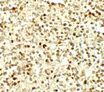 NOX4 Antibody in Immunohistochemistry (Paraffin) (IHC (P))