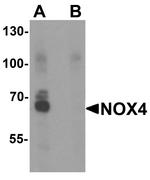 NOX4 Antibody in Western Blot (WB)