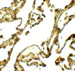 UVRAG Antibody in Immunohistochemistry (Paraffin) (IHC (P))