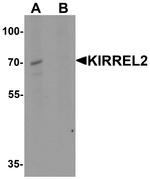 KIRREL2 Antibody in Western Blot (WB)