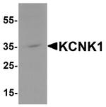 KCNK1 Antibody in Western Blot (WB)