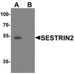 SESN2 Antibody in Western Blot (WB)