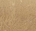 CaV3.2 Antibody in Immunohistochemistry (Paraffin) (IHC (P))