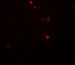 DTX4 Antibody in Immunohistochemistry (Paraffin) (IHC (P))