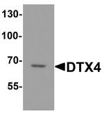 DTX4 Antibody in Western Blot (WB)