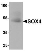 SOX4 Antibody in Western Blot (WB)