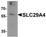 PMAT Antibody in Western Blot (WB)