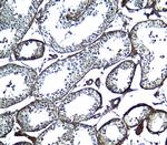 UBD Antibody in Immunohistochemistry (Paraffin) (IHC (P))