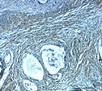 PMEPA1 Antibody in Immunohistochemistry (Paraffin) (IHC (P))