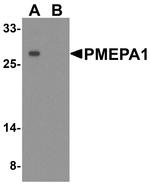 PMEPA1 Antibody in Western Blot (WB)