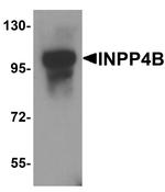 INPP4B Antibody in Western Blot (WB)