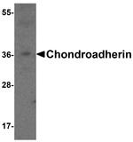 CHAD Antibody in Western Blot (WB)