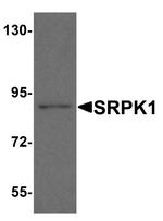 SRPK1 Antibody in Western Blot (WB)