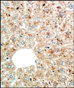 Perilipin 1 Antibody in Immunohistochemistry (Paraffin) (IHC (P))