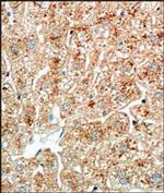 Perilipin 1 Antibody in Immunohistochemistry (Paraffin) (IHC (P))