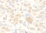 FUSIP1 Antibody in Immunohistochemistry (Paraffin) (IHC (P))