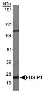 FUSIP1 Antibody in Western Blot (WB)