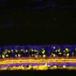 SHANK1 Antibody in Immunohistochemistry (Paraffin) (IHC (P))