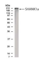 SHANK1 Antibody in Western Blot (WB)