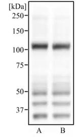 ABCG1 Antibody in Western Blot (WB)