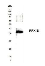 RFXANK Antibody in Western Blot (WB)