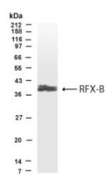 RFXANK Antibody in Western Blot (WB)