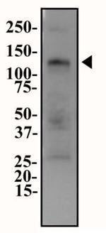 ENPP1 Antibody in Western Blot (WB)