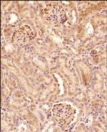 Pyruvate Carboxylase Antibody in Immunohistochemistry (Paraffin) (IHC (P))