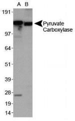 Pyruvate Carboxylase Antibody in Western Blot (WB)