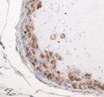 PMSCL1 Antibody in Immunohistochemistry (Paraffin) (IHC (P))