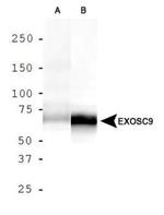 PMSCL1 Antibody in Western Blot (WB)