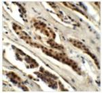 GLS2 Antibody in Immunohistochemistry (Paraffin) (IHC (P))