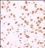 GLI1 Antibody in Immunohistochemistry (Paraffin) (IHC (P))