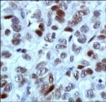 MBD4 Antibody in Immunohistochemistry (Paraffin) (IHC (P))