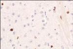 PIF1 Antibody in Immunohistochemistry (Paraffin) (IHC (P))