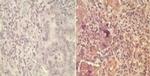 WNT5A Antibody in Immunohistochemistry (Paraffin) (IHC (P))