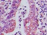 AP3D1 Antibody in Immunohistochemistry (Paraffin) (IHC (P))